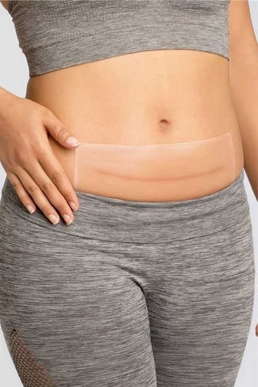 Amoena CuraScar Patch Amoena CuraScar Silicone Square Patches